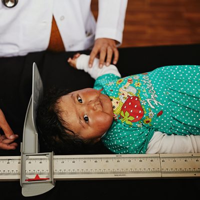 Boliviaanse baby wordt gemeten.